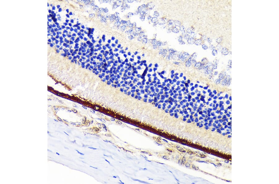Immunohistochemistry - Anti-RPE65 Antibody [ARC1659] (A308904) - Antibodies.com