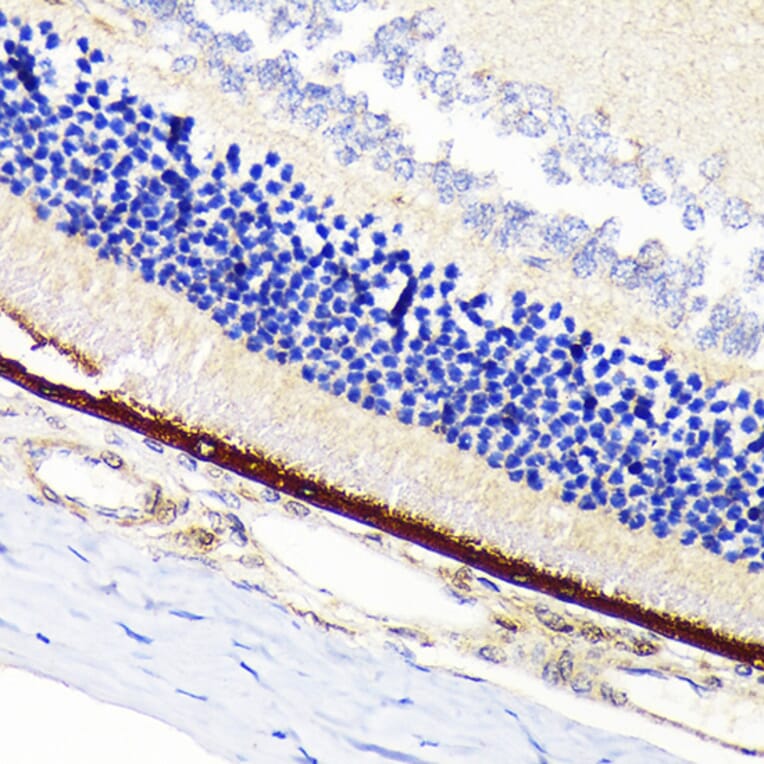 Immunohistochemistry - Anti-RPE65 Antibody [ARC1659] (A308904) - Antibodies.com