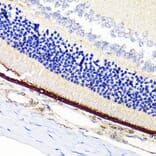 Immunohistochemistry - Anti-RPE65 Antibody [ARC1659] (A308904) - Antibodies.com