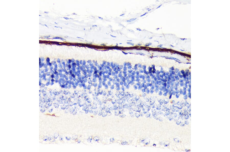 Immunohistochemistry - Anti-RPE65 Antibody [ARC1659] (A308904) - Antibodies.com