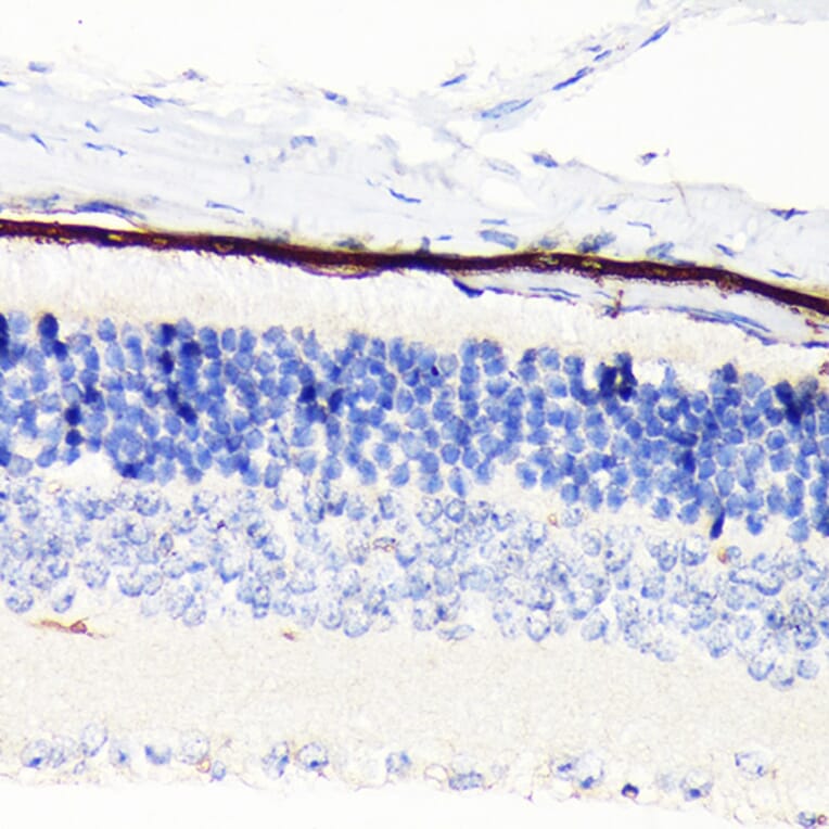 Immunohistochemistry - Anti-RPE65 Antibody [ARC1659] (A308904) - Antibodies.com