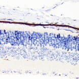 Immunohistochemistry - Anti-RPE65 Antibody [ARC1659] (A308904) - Antibodies.com