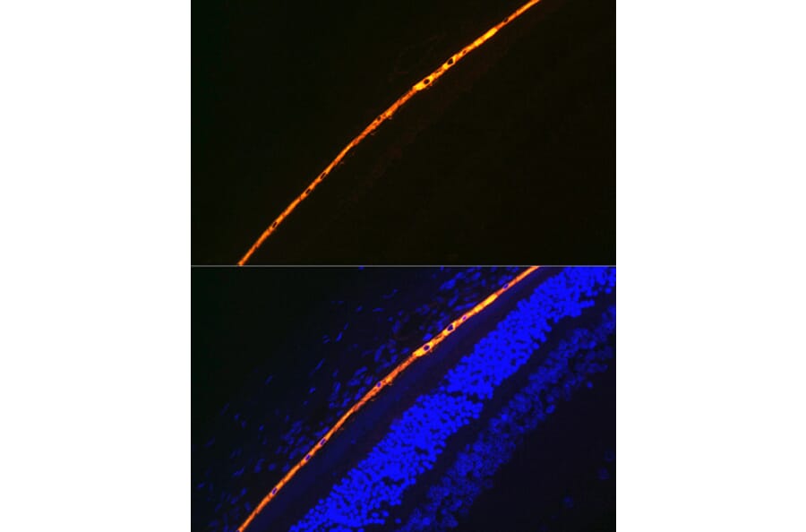 Immunofluorescence - Anti-RPE65 Antibody [ARC1659] (A308904) - Antibodies.com