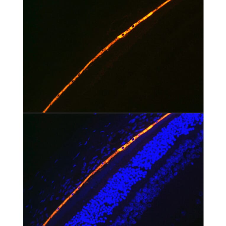 Immunofluorescence - Anti-RPE65 Antibody [ARC1659] (A308904) - Antibodies.com