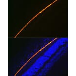 Immunofluorescence - Anti-RPE65 Antibody [ARC1659] (A308904) - Antibodies.com