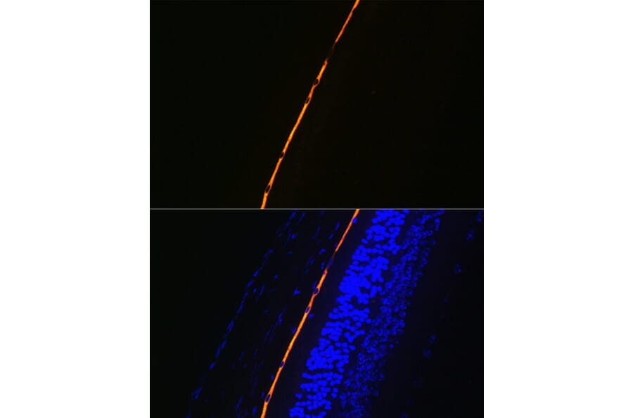 Immunofluorescence - Anti-RPE65 Antibody [ARC1659] (A308904) - Antibodies.com