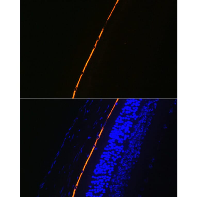 Immunofluorescence - Anti-RPE65 Antibody [ARC1659] (A308904) - Antibodies.com