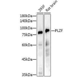 Western Blot - Anti-Plzf Antibody [ARC52265] (A308905) - Antibodies.com