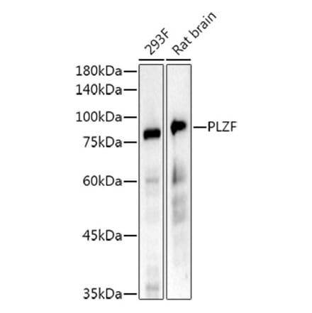 Western Blot - Anti-Plzf Antibody [ARC52265] (A308905) - Antibodies.com