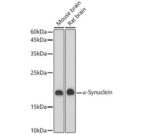 Western Blot - Anti-Alpha-synuclein Antibody [ARC50333] (A308906) - Antibodies.com