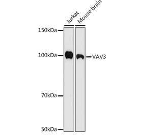 Western Blot - Anti-VAV3 Antibody [ARC1647] (A308909) - Antibodies.com