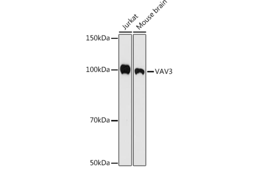 Western Blot - Anti-VAV3 Antibody [ARC1647] (A308909) - Antibodies.com