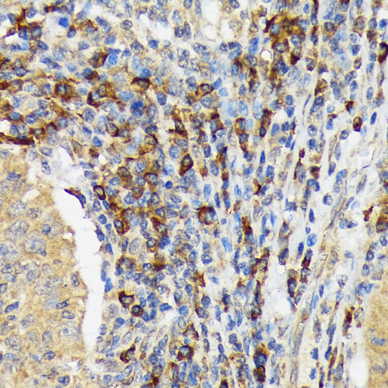 Immunohistochemistry - Anti-VAV3 Antibody [ARC1647] (A308909) - Antibodies.com
