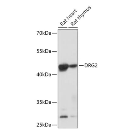 Western Blot - Anti-DRG2 Antibody (A308910) - Antibodies.com