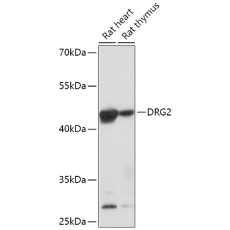 Western Blot - Anti-DRG2 Antibody (A308910) - Antibodies.com
