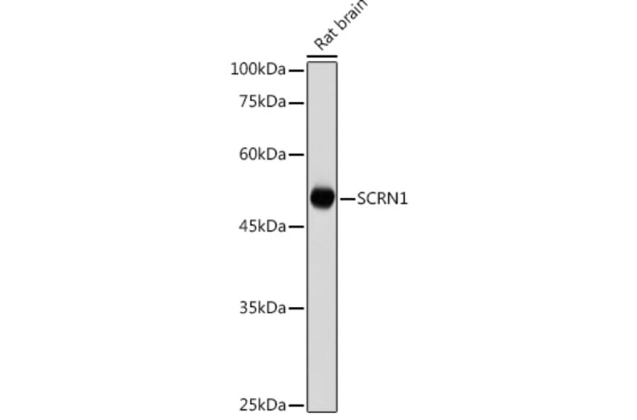 Western Blot - Anti-SCRN1 Antibody (A308911) - Antibodies.com