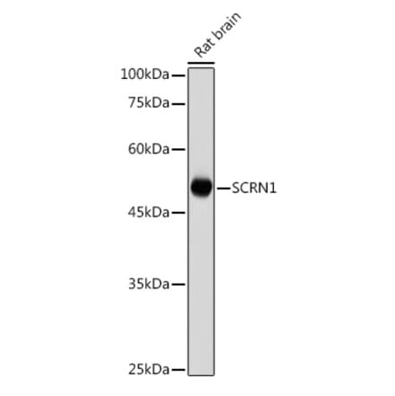 Western Blot - Anti-SCRN1 Antibody (A308911) - Antibodies.com