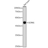 Western Blot - Anti-SCRN1 Antibody (A308911) - Antibodies.com