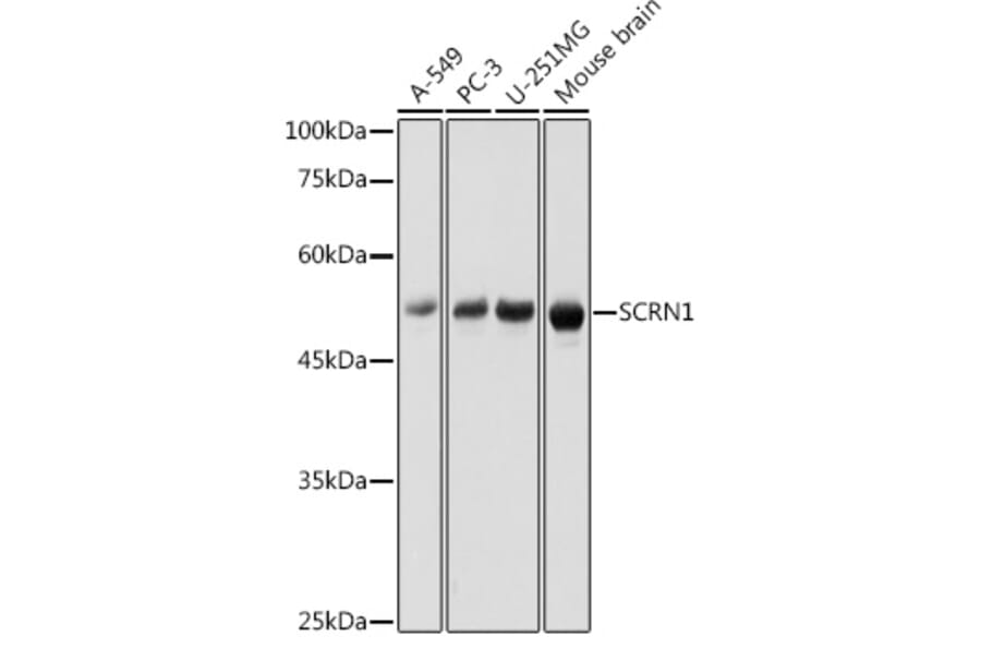 Western Blot - Anti-SCRN1 Antibody (A308911) - Antibodies.com