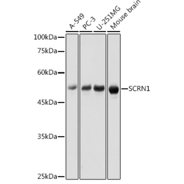 Western Blot - Anti-SCRN1 Antibody (A308911) - Antibodies.com