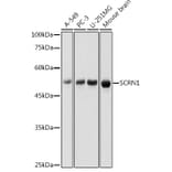 Western Blot - Anti-SCRN1 Antibody (A308911) - Antibodies.com