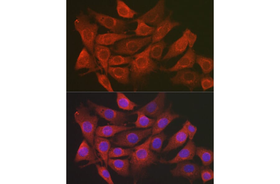 Immunofluorescence - Anti-SCRN1 Antibody (A308911) - Antibodies.com