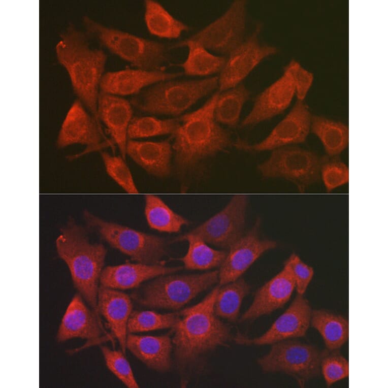 Immunofluorescence - Anti-SCRN1 Antibody (A308911) - Antibodies.com