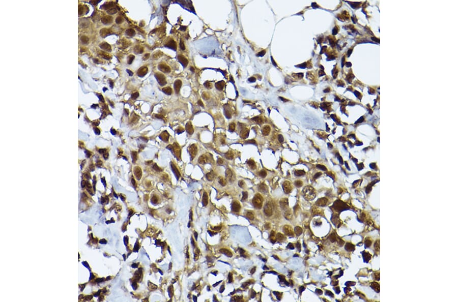 Immunohistochemistry - Anti-STAT3 Antibody [ARC2603] (A308912) - Antibodies.com
