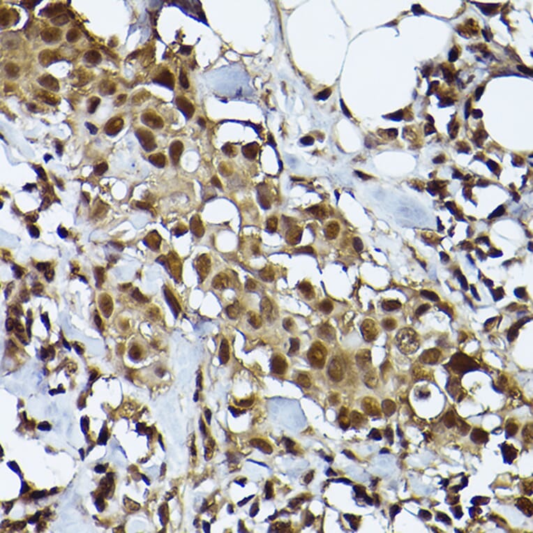Immunohistochemistry - Anti-STAT3 Antibody [ARC2603] (A308912) - Antibodies.com