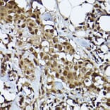 Immunohistochemistry - Anti-STAT3 Antibody [ARC2603] (A308912) - Antibodies.com