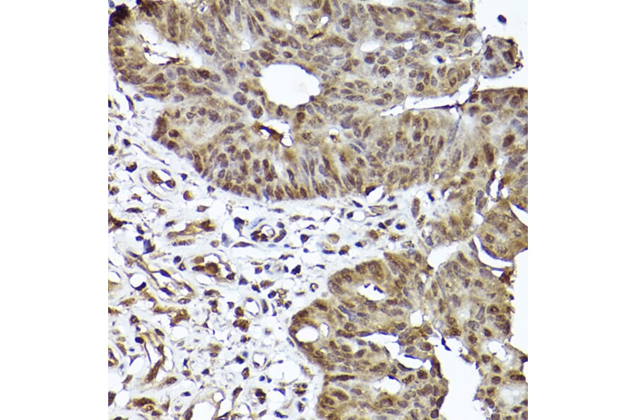 Immunohistochemistry - Anti-STAT3 Antibody [ARC2603] (A308912) - Antibodies.com