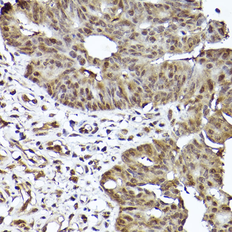 Immunohistochemistry - Anti-STAT3 Antibody [ARC2603] (A308912) - Antibodies.com
