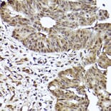 Immunohistochemistry - Anti-STAT3 Antibody [ARC2603] (A308912) - Antibodies.com