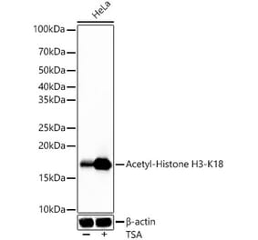 Western Blot - Anti-Histone H3 (acetyl Lys18) Antibody [ARC55729] (A308917) - Antibodies.com