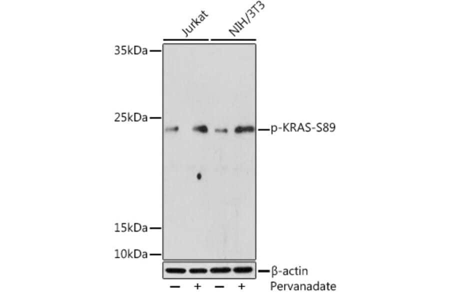 Western Blot - Anti-KRAS (phospho Ser89) Antibody (A308919) - Antibodies.com