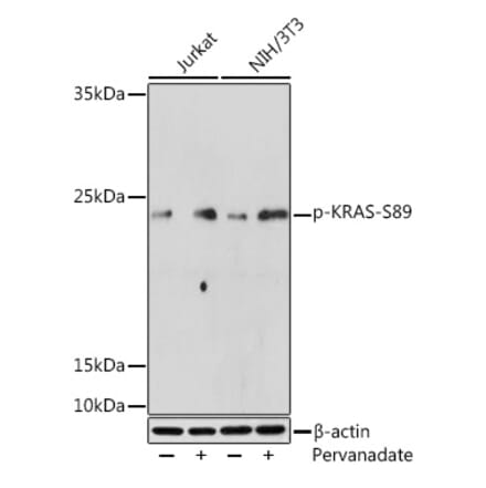 Western Blot - Anti-KRAS (phospho Ser89) Antibody (A308919) - Antibodies.com