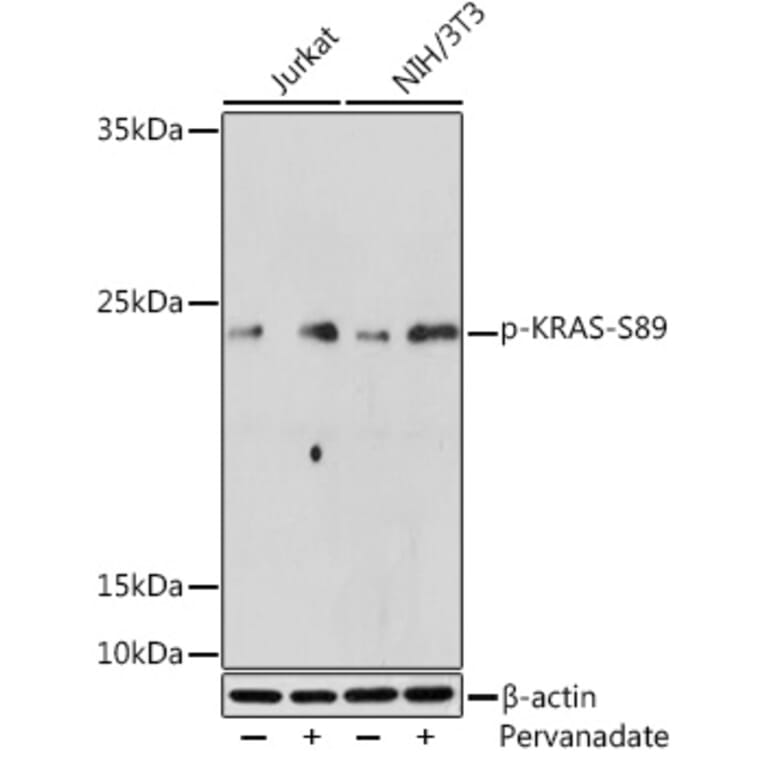 Western Blot - Anti-KRAS (phospho Ser89) Antibody (A308919) - Antibodies.com
