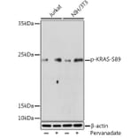 Western Blot - Anti-KRAS (phospho Ser89) Antibody (A308919) - Antibodies.com