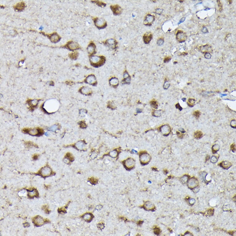 Immunohistochemistry - Anti-KRAS (phospho Ser89) Antibody (A308919) - Antibodies.com