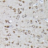 Immunohistochemistry - Anti-KRAS (phospho Ser89) Antibody (A308919) - Antibodies.com