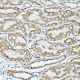 Immunohistochemistry - Anti-KRAS (phospho Ser89) Antibody (A308919) - Antibodies.com