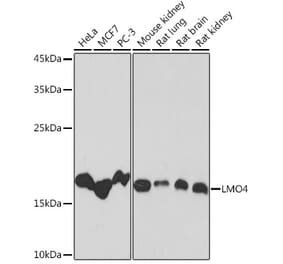 Western Blot - Anti-LMO4 Antibody [ARC2114] (A308920) - Antibodies.com
