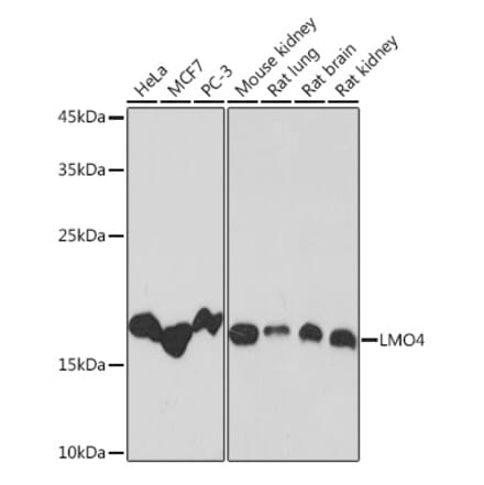 Western Blot - Anti-LMO4 Antibody [ARC2114] (A308920) - Antibodies.com