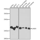 Western Blot - Anti-LMO4 Antibody [ARC2114] (A308920) - Antibodies.com