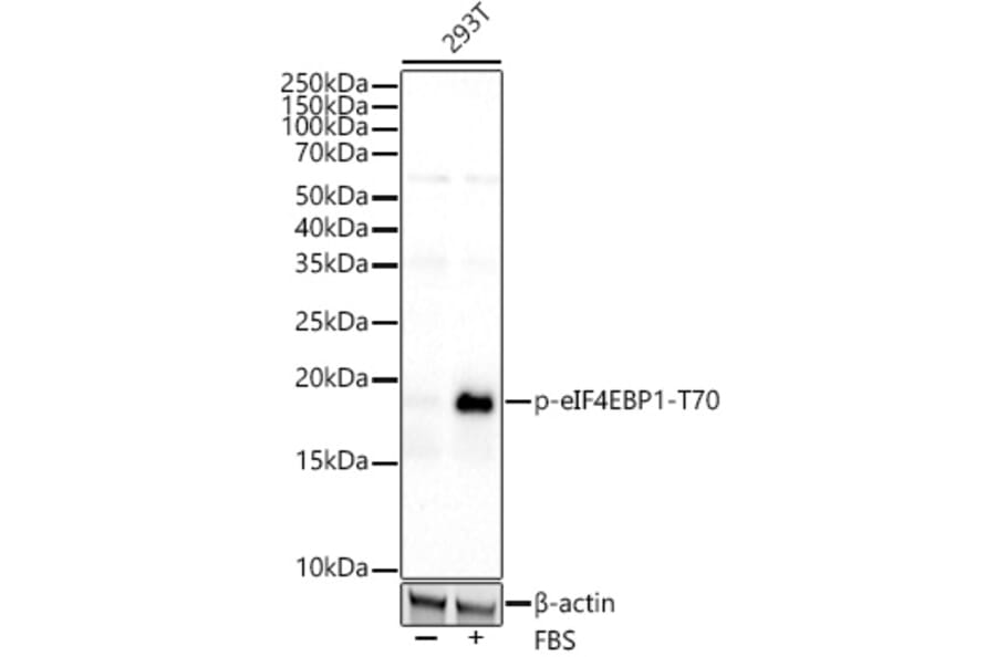 Western Blot - Anti-eIF4EBP1 (phospho Thr70) Antibody [ARC53785] (A308921) - Antibodies.com