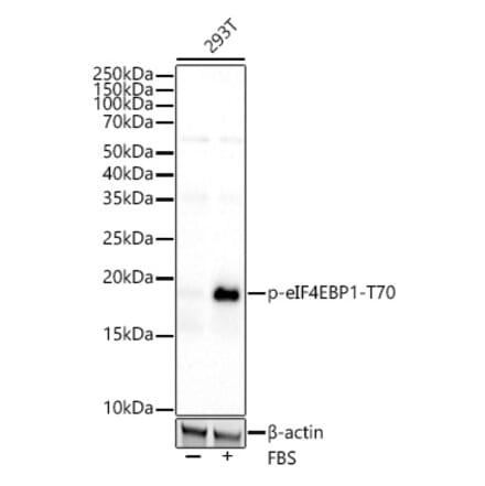 Western Blot - Anti-eIF4EBP1 (phospho Thr70) Antibody [ARC53785] (A308921) - Antibodies.com
