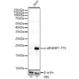 Western Blot - Anti-eIF4EBP1 (phospho Thr70) Antibody [ARC53785] (A308921) - Antibodies.com