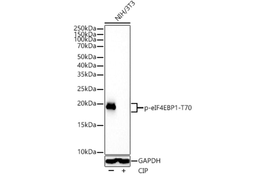 Western Blot - Anti-eIF4EBP1 (phospho Thr70) Antibody [ARC53785] (A308921) - Antibodies.com
