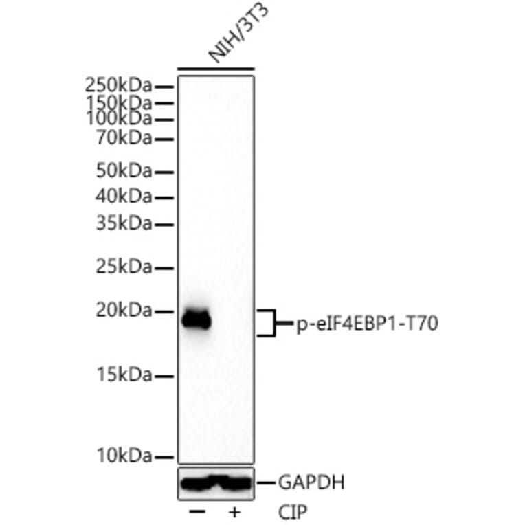 Western Blot - Anti-eIF4EBP1 (phospho Thr70) Antibody [ARC53785] (A308921) - Antibodies.com