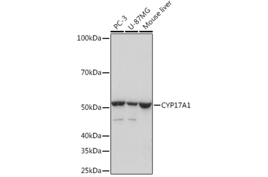 Western Blot - Anti-Cytochrome P450 17A1/CYP17A1 Antibody [ARC1257] (A308923) - Antibodies.com